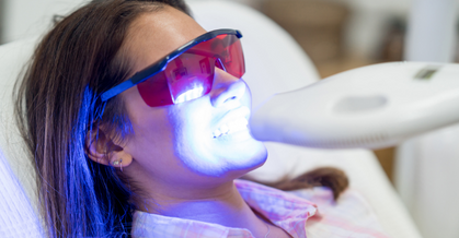 Dental Laser Teeth Whitening